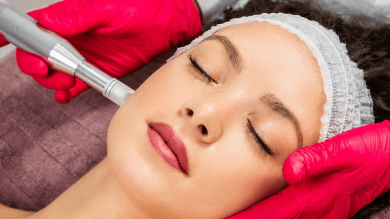 Is Microneedling the Future of Fashion Beauty