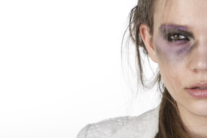 Career Challenges for Fashion Professionals After Medical Negligence